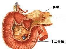 胰高血糖素瘤 胰高血糖素瘤