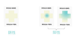 便潛血檢測結果陽性對照圖