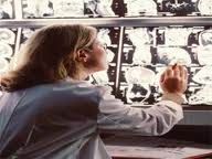 結腸類癌 結腸類癌