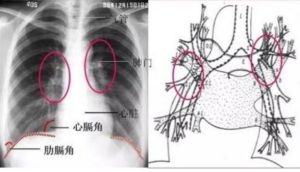 矛盾呼吸 矛盾呼吸