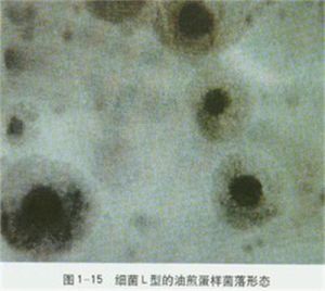 弗氏玫瑰鏈黴菌 弗氏玫瑰鏈黴菌