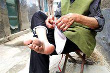 裹腳[舊時陋習]