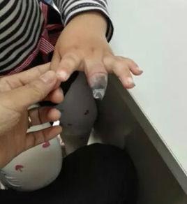 創可貼事件 創可貼事件