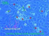 血管內皮細胞 血管內皮細胞