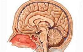 逐漸性腦衰竭 逐漸性腦衰竭