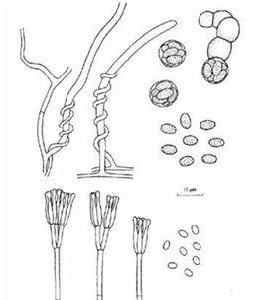 黃色籃狀菌 黃色籃狀菌