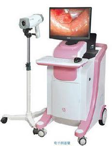 數碼陰道鏡 數碼陰道鏡