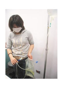 腹膜透析 腹膜透析