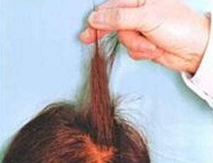 生長期脫髮 生長期脫髮