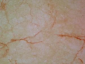 金屬印花裝飾板花紋和套用