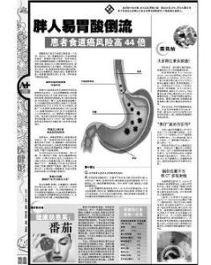 胃酸倒流 胃酸倒流