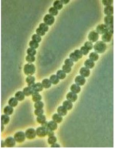 串珠型硝化細菌