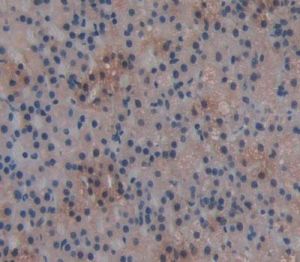 葡糖-6-磷酸脫氫酶 葡糖-6-磷酸脫氫酶