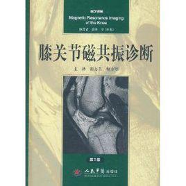 膝關節磁共振診斷 膝關節磁共振診斷
