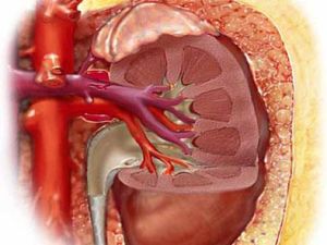 腎性腦病 腎性腦病