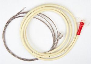 乳汁吸入性肺炎