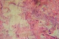 索氏梭菌 索氏梭菌