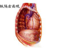 繼發性縱隔感染