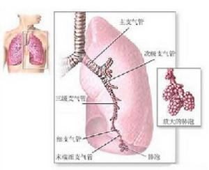 巴斯德菌肺炎 巴斯德菌肺炎