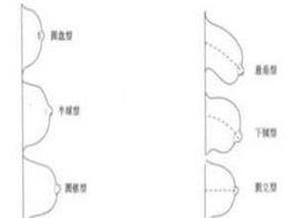 乳房和生殖器萎縮 乳房和生殖器萎縮