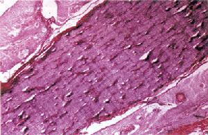 視神經損害 視神經損害