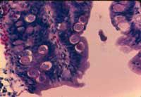 球蟲在腸道中成倍增殖