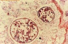 金針菇麴黴 金針菇麴黴