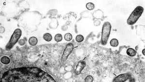 立克次氏體科 立克次氏體科