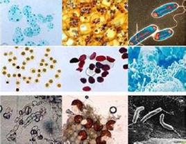 細菌污染指標 細菌污染指標