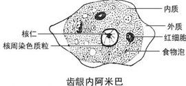 齒齦內阿米巴 齒齦內阿米巴
