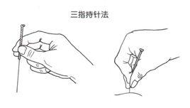 單式針刺手法 單式針刺手法