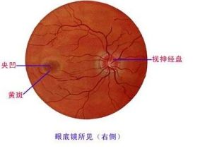 眼底鏡下的視網膜