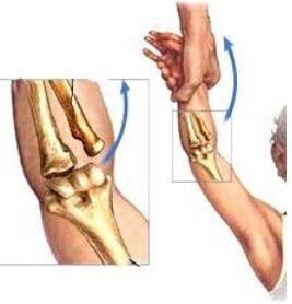 股骨頸骨折閉合復位加壓螺紋釘內固定術 股骨頸骨折閉合復位加壓螺紋釘內固定術