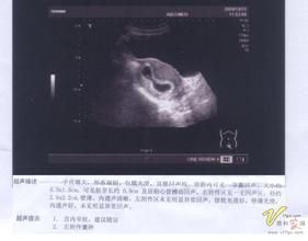 胎心搏動 胎心搏動