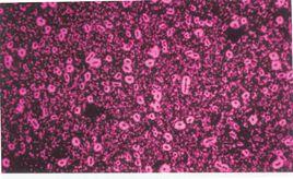 莢膜染色法 莢膜染色法