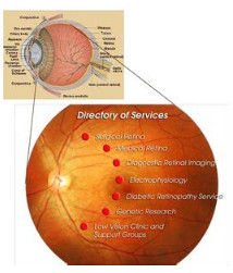 視網膜炎 視網膜炎