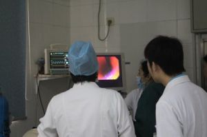 老年人腸易激綜合徵 老年人腸易激綜合徵