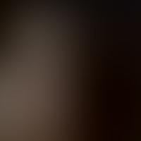 IC 1082 RASS 彩色圖