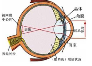 視網膜動脈阻塞