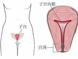 子宮內膜增厚