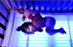 克里格勒-納賈爾綜合徵 