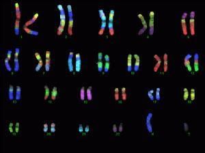 遺傳性凝血因子ⅩⅢ缺乏 遺傳性凝血因子ⅩⅢ缺乏
