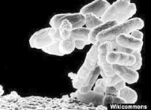 顯微鏡下的“超級細菌”
