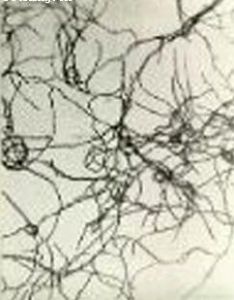 豬諾卡氏菌病 豬諾卡氏菌病