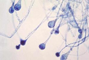 真菌有性孢子繁殖 真菌有性孢子繁殖