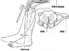 急性感染性多發性神經根神經炎