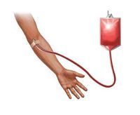 自體輸血 自體輸血