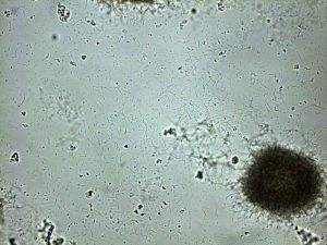 列斯克鏈黴菌 列斯克鏈黴菌