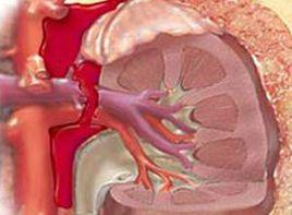 腎臟破裂 腎臟破裂