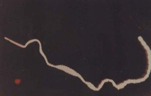 雞絛蟲病 雞絛蟲病